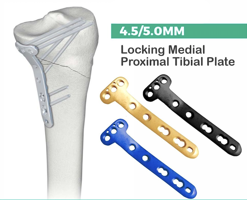 Locking Medial Proximal Tibial Plates (Prod 230707)